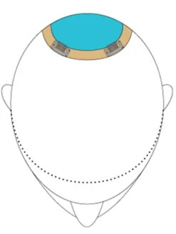 Top This 8" | Remy Human Hair Topper 27 Top This 8" | Remy Human Hair Topper -Wigs - Jon Renau TopThis placement