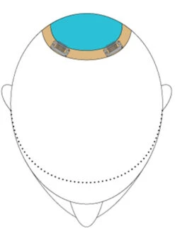 Top This 12" | Remy Human Hair Topper -Wigs - Jon Renau TopThis placement 95878395 3a51 4b72 86c9 2fb5ccd03dcf